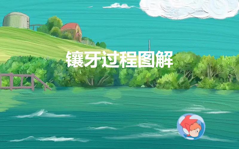 镶牙过程图解（镶牙的步骤是怎样的）